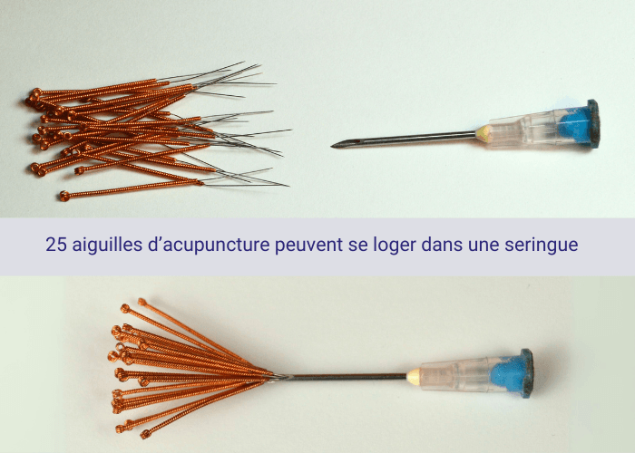Photo montrant 25 aiguilles d'acupuncture qui se logent toutes à l'intérieur de l'aiguille d'une seringue.