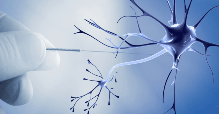 Comment ça marche l&rsquo;acupuncture?  Les mécanismes biologiques en réponse à la stimulation de l&rsquo;aiguille