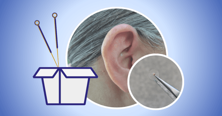 Les billes d’acupuncture: infos et marche à suivre